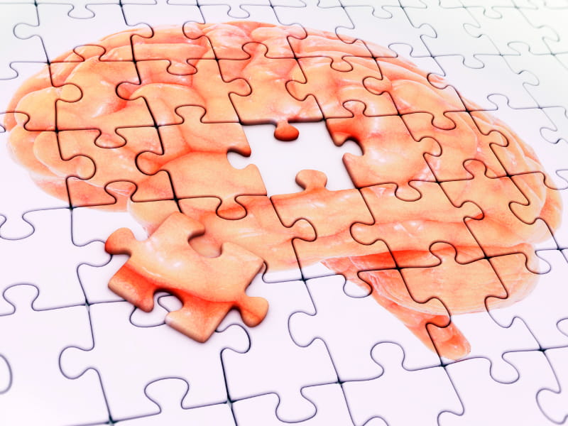 A 1000-piece jigsaw puzzle designed to assist individuals with ADHD. The puzzle depicts an image of a brain illustration.